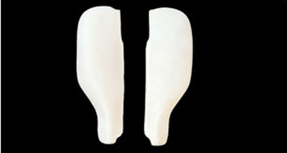 Recaro Wangen Set